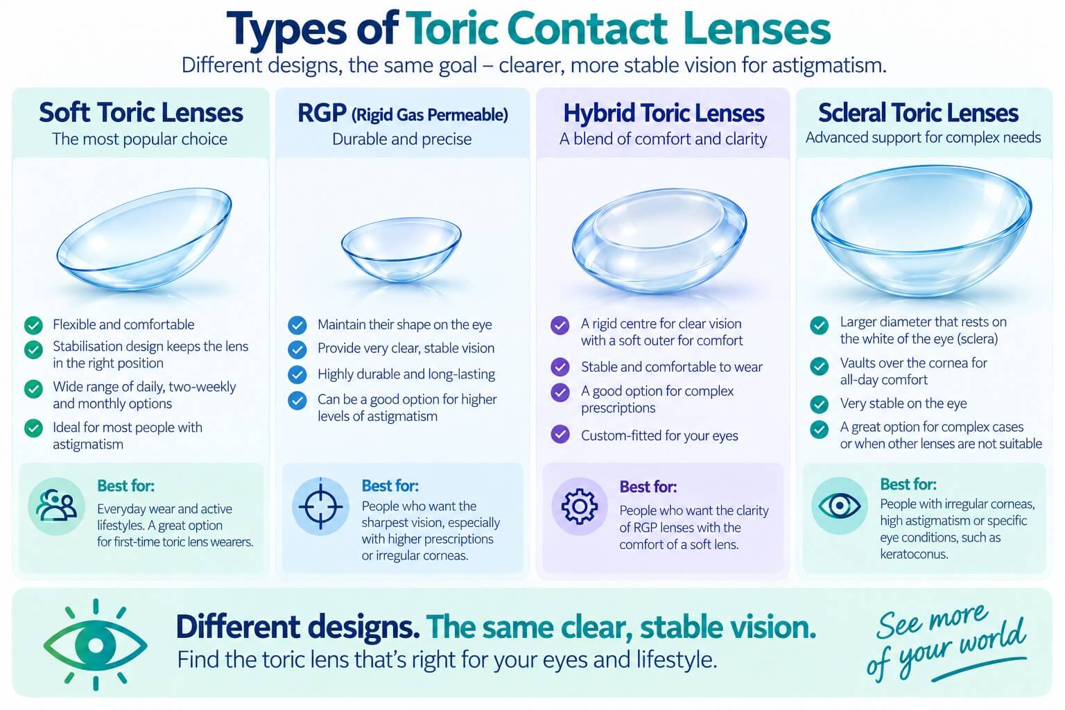 What are toric contact lenses? | Astigmatism